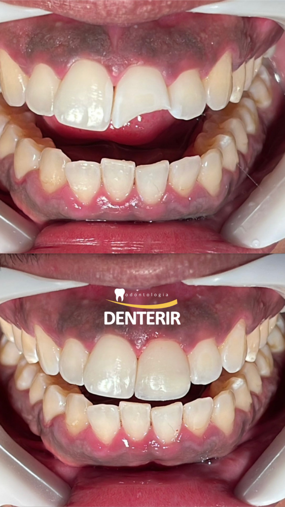 Galeria DENTERIR Odontologia